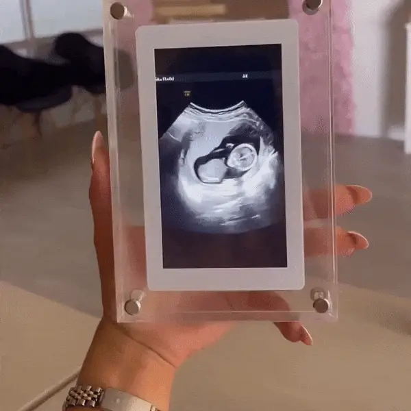 Forever Treasure Memory Frame™︎ - Image 7